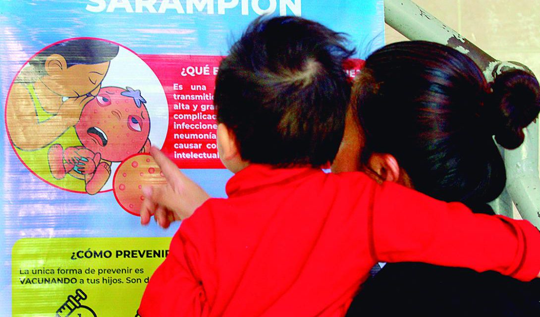 Confirman 20 casos de sarampión; hay alerta sanitaria nacional