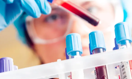 Cochabamba reportó seis casos de H3N2, pero solo uno con sospecha de la variante K, señala el Sedes