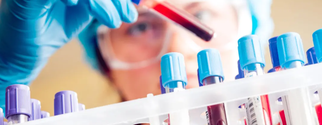 Cochabamba reportó seis casos de H3N2, pero solo uno con sospecha de la variante K, señala el Sedes