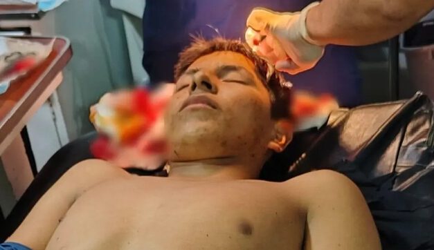 Policía reporta estable a uniformado herido por impacto de bala en operativo de San Julián